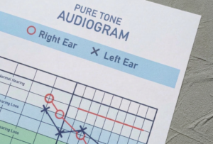 ahc-pure-tone-audiogram
